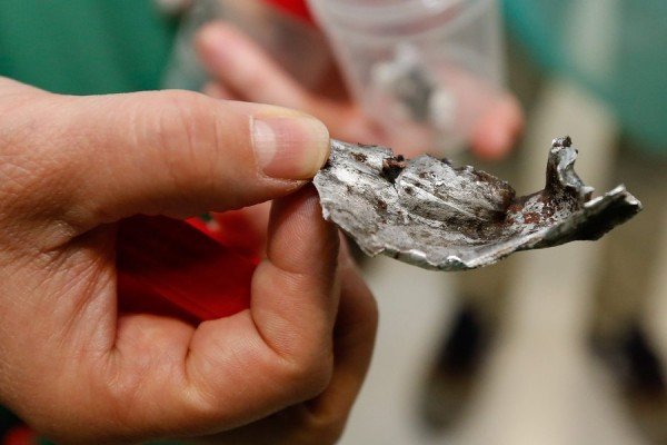 Εβγαλαν βίδες και μεταλλικά θραύσματα από τα θύματα των επιθέσεων στις Βρυξέλλες [εικόνες] | iefimerida.gr 8