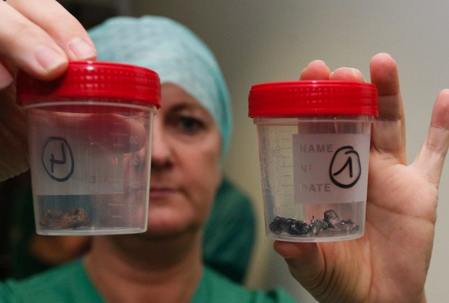 Εβγαλαν βίδες και μεταλλικά θραύσματα από τα θύματα των επιθέσεων στις Βρυξέλλες [εικόνες] | iefimerida.gr 13