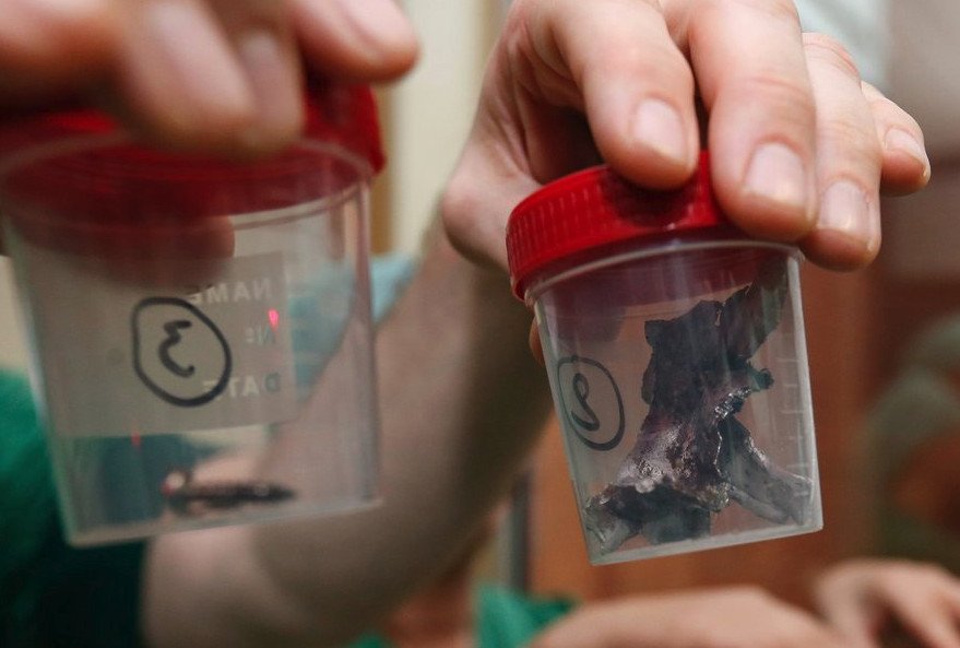 Εβγαλαν βίδες και μεταλλικά θραύσματα από τα θύματα των επιθέσεων στις Βρυξέλλες [εικόνες] | iefimerida.gr 12