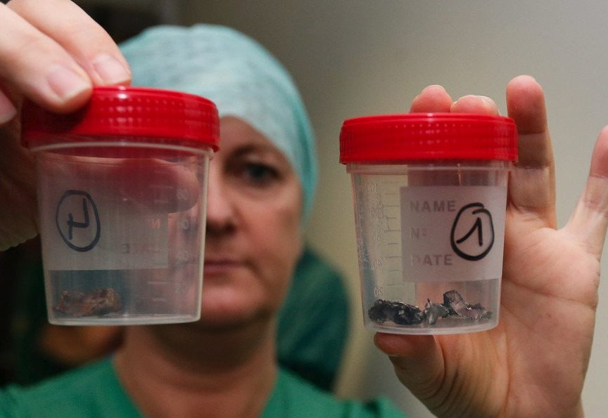 Εβγαλαν βίδες και μεταλλικά θραύσματα από τα θύματα των επιθέσεων στις Βρυξέλλες [εικόνες] | iefimerida.gr 11