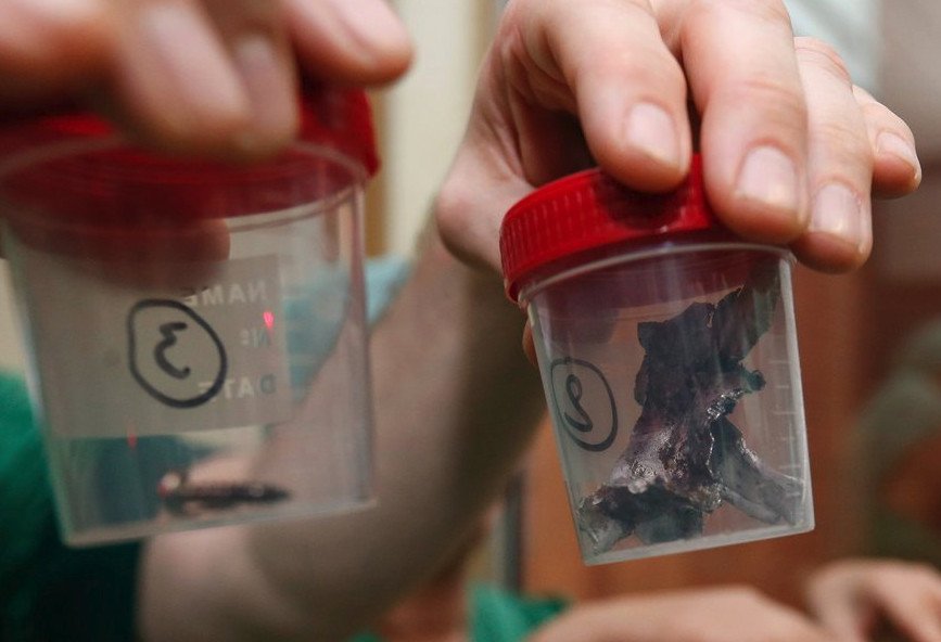 Εβγαλαν βίδες και μεταλλικά θραύσματα από τα θύματα των επιθέσεων στις Βρυξέλλες [εικόνες] | iefimerida.gr 10