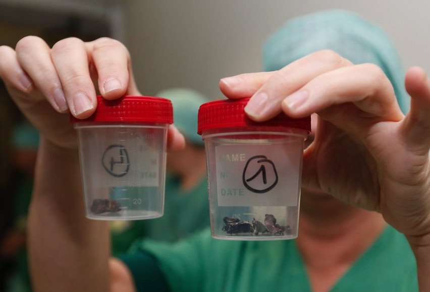 Εβγαλαν βίδες και μεταλλικά θραύσματα από τα θύματα των επιθέσεων στις Βρυξέλλες [εικόνες] | iefimerida.gr 9