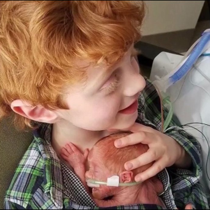 Η φωτογραφία ενός τρίχρονου που κρατά αγκαλιά το 7μηνίτικο αδελφάκι του έλιωσε το Ιντερνετ [εικόνες] | iefimerida.gr 0