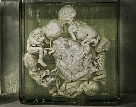 Πέντε εντυπωσιακά μακάβρια αξιοθέατα στην Ευρώπη [εικόνες] | iefimerida.gr 2