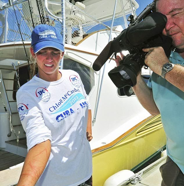 Τα δολοφονικά τσιμπήματα της μέδουσας στο κορμί της 28χρονης κολυμβήτριας [εικόνες] | iefimerida.gr 2