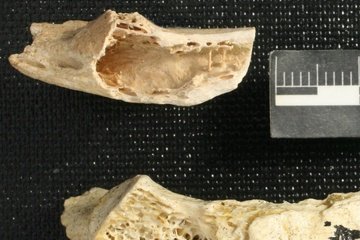 Αρχαιολόγοι εντόπισαν όγκο ηλικίας 120.000 ετών σε σκελετό Νεάντερνταλ [εικόνες] | iefimerida.gr 1