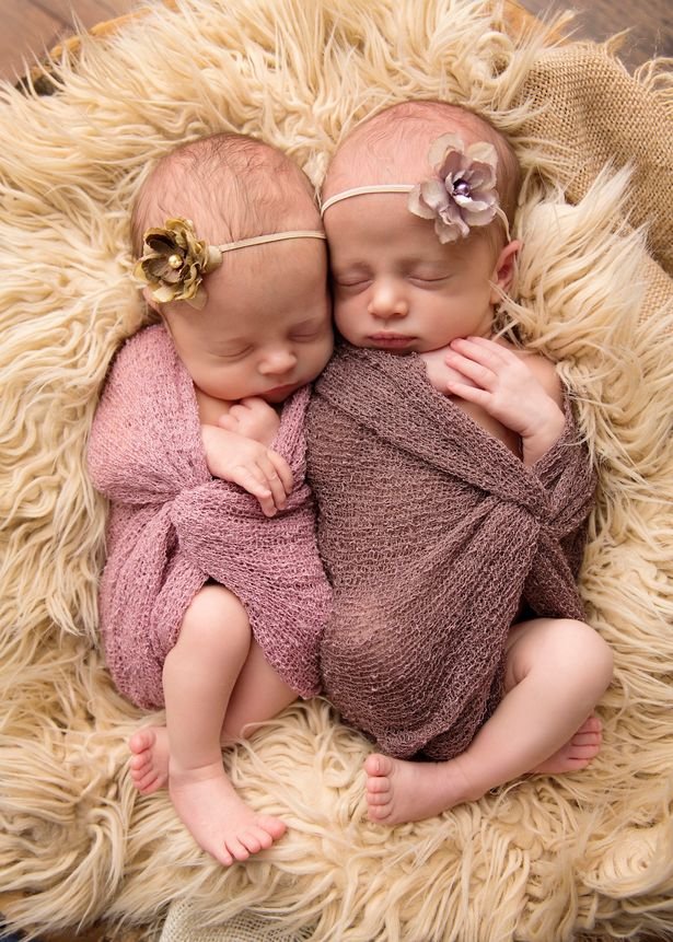 Τα νεογέννητα δίδυμα που λιώνουν το διαδίκτυο [εικόνες] | iefimerida.gr 4