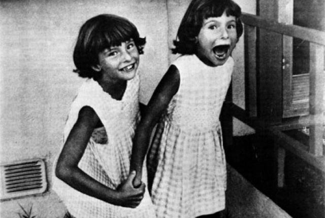 Οι τραγικές ζωές ασυνήθιστων διδύμων στην Ιστορία [εικόνες] | iefimerida.gr 0