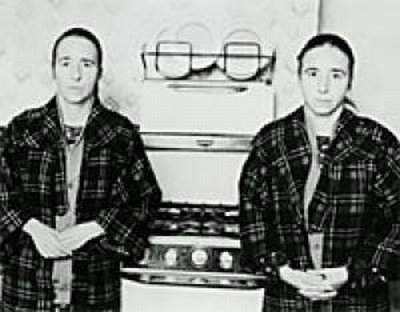 Οι τραγικές ζωές ασυνήθιστων διδύμων στην Ιστορία [εικόνες] | iefimerida.gr 1