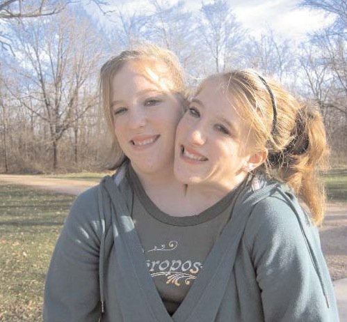 Οι τραγικές ζωές ασυνήθιστων διδύμων στην Ιστορία [εικόνες] | iefimerida.gr 3