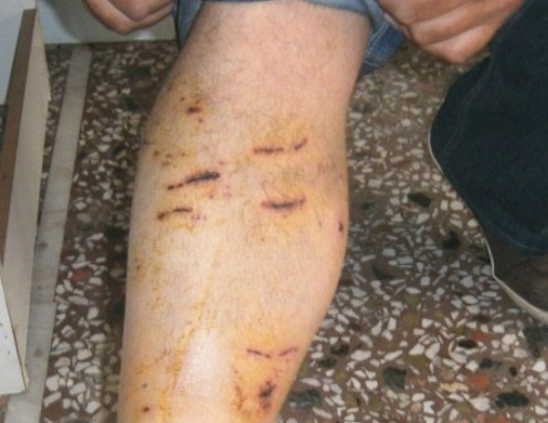 Νέα επίθεση από άγρια σκυλιά σε αγρότη στη Λάρισα -Τον δάγκωσαν σε όλο του το σώμα [εικόνες] | iefimerida.gr 1