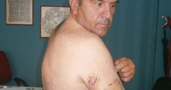 Νέα επίθεση από άγρια σκυλιά σε αγρότη στη Λάρισα -Τον δάγκωσαν σε όλο του το σώμα [εικόνες] | iefimerida.gr 0