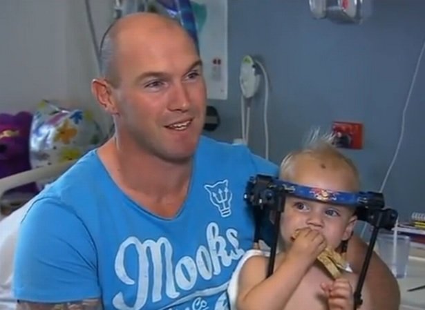 Ενα χειρουργικό θαύμα - 16 μηνών αγόρι υπέστη εσωτερικό αποκεφαλισμό και τα κατάφερε [εικόνες] | iefimerida.gr 3