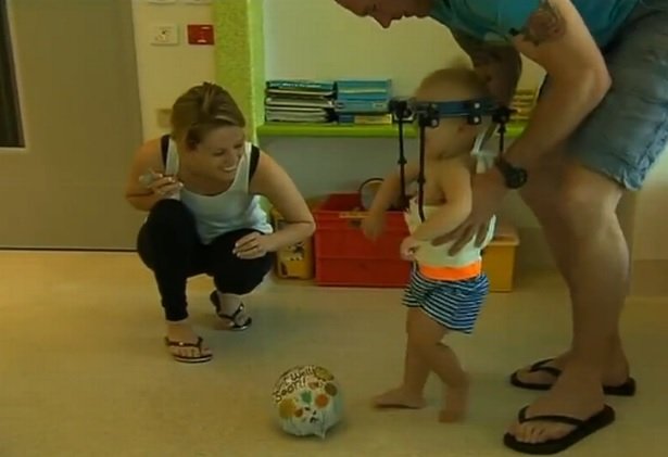 Ενα χειρουργικό θαύμα - 16 μηνών αγόρι υπέστη εσωτερικό αποκεφαλισμό και τα κατάφερε [εικόνες] | iefimerida.gr 4