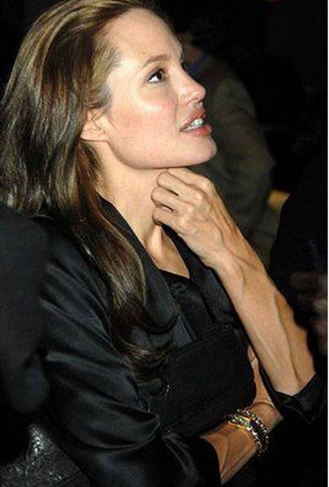 Ξανά στο χειρουργείο η Τζολί -Τι την κάνει να αισθάνεται «φρικιό» και θέλει να το διορθώσει [εικόνες] | iefimerida.gr 4