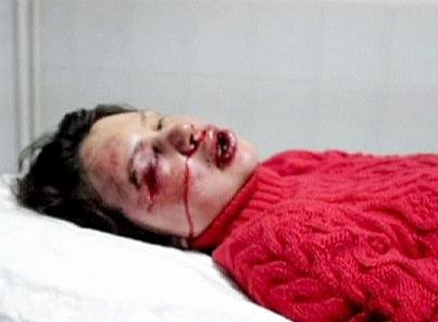 Ουκρανία: Ξυλοκόπησαν διάσημη δημοσιογράφο-ακριβίστρια -Αγριες διαδηλώσεις στη χώρα [εικόνες+βίντεο] | iefimerida.gr 5