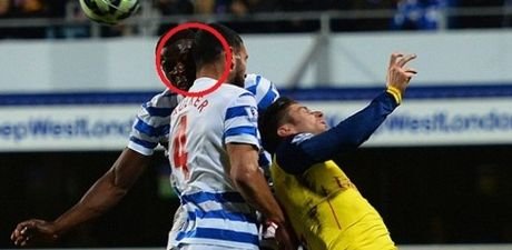 Τραυματισμός σοκ για παίκτη της Premier League [εικόνες] | iefimerida.gr 0