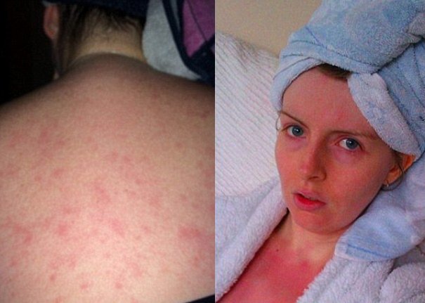 Κι όμως αυτή η κοπέλα έχει αλλεργία στο νερό [εικόνες] | iefimerida.gr 0