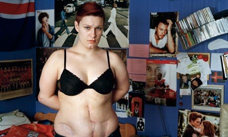 Ενα σπαρακτικό μνημείο για τα θύματα του Μπρέιβικ, στη Νορβηγία -Αναπαριστά μια πληγή [εικόνες] | iefimerida.gr 2