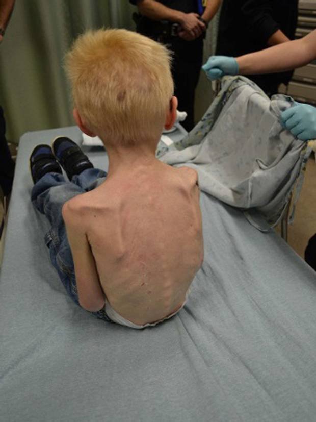 Σοκ στο Τέξας: Κρατούσαν το 5χρονο παιδί τους νηστικό κλειδωμένο κάτω από τη σκάλα [εικόνες] | iefimerida.gr 0