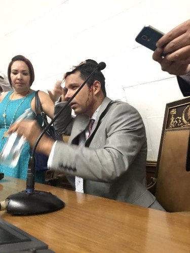 Βενεζουέλα: Οπαδοί του Μαδούρο εισέβαλαν στη Βουλή και τραυμάτισαν βουλευτές της αντιπολίτευσης [εικόνες] | iefimerida.gr 4