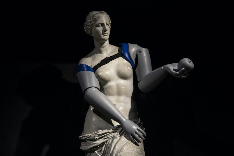 ΜΚΟ «φόρεσε» προσθετικά μέλη στην Αφροδίτη της Μήλου, για καλό σκοπό [βίντεο] | iefimerida.gr 0