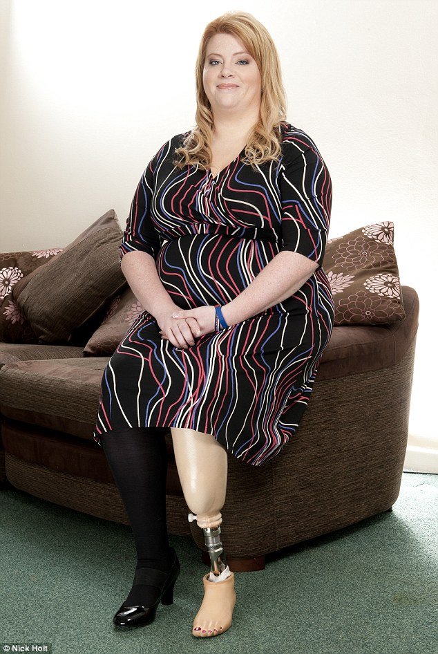 Η βιονική γυναίκα: Στρατιώτης επέζησε από έκρηξη σε πόλεμο και πλήρωσε 62.000 ευρώ για την «ανακατασκευή» της [εικόνες] | iefimerida.gr 4