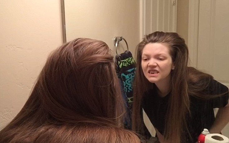 Ετσι είναι η ζωή-εφιάλτης μιας βουλιμικής [βίντεο] | iefimerida.gr 3