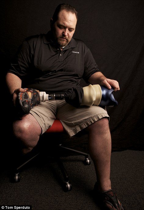 Οι φωτογραφίες που δεν δείχνουν ποτέ από ένα πόλεμο -Ακρωτηριασμένοι στρατιώτες ποζάρουν σχεδόν περήφανοι [εικόνες] | iefimerida.gr 5