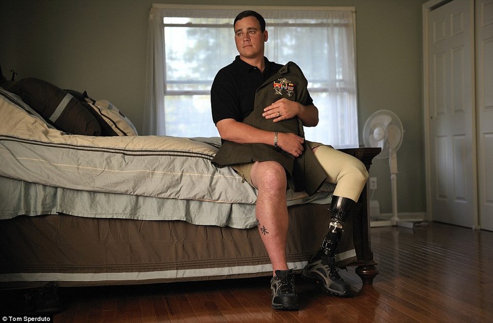 Οι φωτογραφίες που δεν δείχνουν ποτέ από ένα πόλεμο -Ακρωτηριασμένοι στρατιώτες ποζάρουν σχεδόν περήφανοι [εικόνες] | iefimerida.gr 7