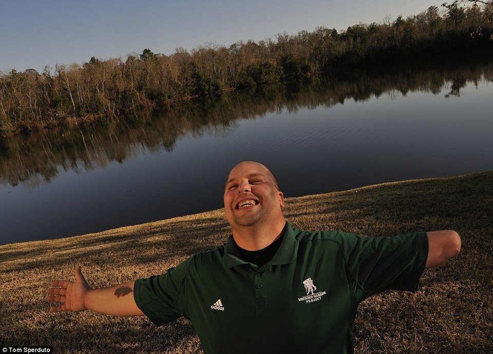 Οι φωτογραφίες που δεν δείχνουν ποτέ από ένα πόλεμο -Ακρωτηριασμένοι στρατιώτες ποζάρουν σχεδόν περήφανοι [εικόνες] | iefimerida.gr 1