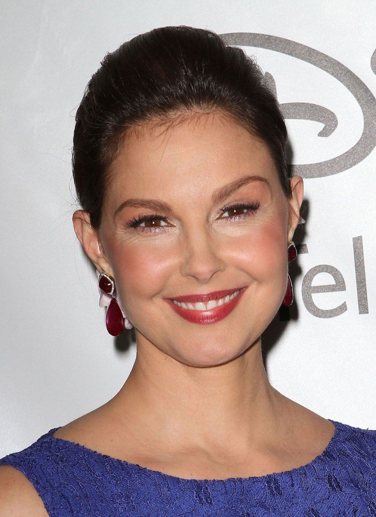 Διάσημη σταρ απέκτησε μάγουλα-τούμπανο από κακή πλαστική [εικόνες] | iefimerida.gr 0