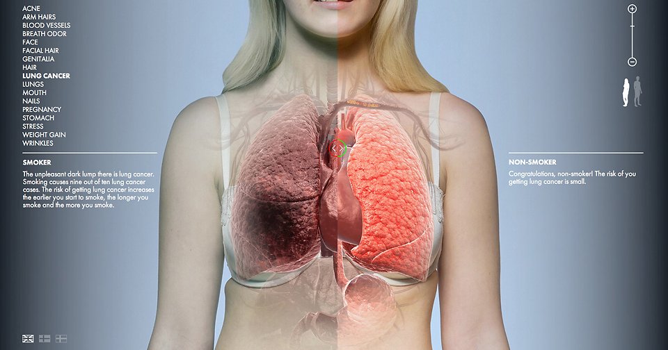 Βρείτε τη διαφορά στο σώμα ενός καπνιστή και ενός αντικαπνιστή-Μια νέα εκστρατεία για τις συνέπειες του τσιγάρου [εικόνες] | iefimerida.gr 2