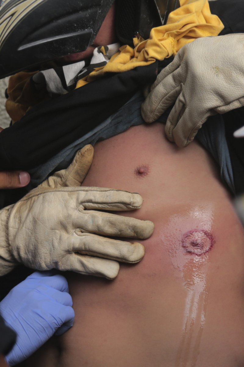 Βενεζουέλα: Αγριες συγκρούσεις στους δρόμους -Στους 34 οι νεκροί [εικόνες & βίντεο]  | iefimerida.gr 3