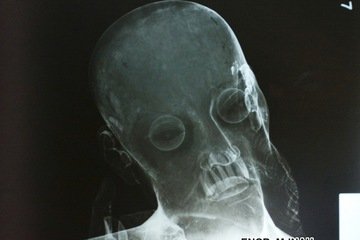 Αληθινά ανθρώπινα δόντια βρέθηκαν σε άγαλμα του Ιησού στο Μεξικό [εικόνες] | iefimerida.gr 1