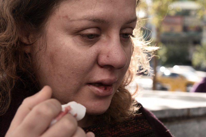 Χρυσαυγίτες επιτέθηκαν σε δύο γυναίκες -Η μία είναι συνήγορος πολιτικής αγωγής στη δίκη της Χ.Α. [εικόνες] | iefimerida.gr 0