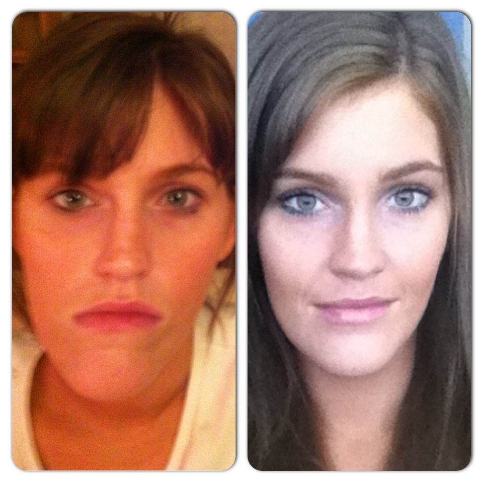 Stefanie Grant: Η πανέμορφη 25χρονη που περίμενε 15 χρόνια για να χαμογελάσει [εικόνες] | iefimerida.gr 2