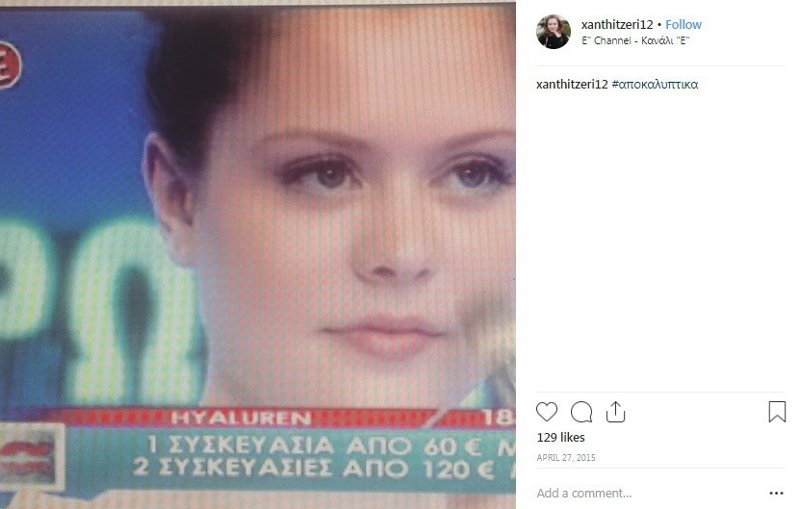 GNTM: Κι όμως η Ξανθούλα είχε διαφημίσει υαλουρονικό στην εκπομπή του Φουρθιώτη [εικόνα] | iefimerida.gr 0