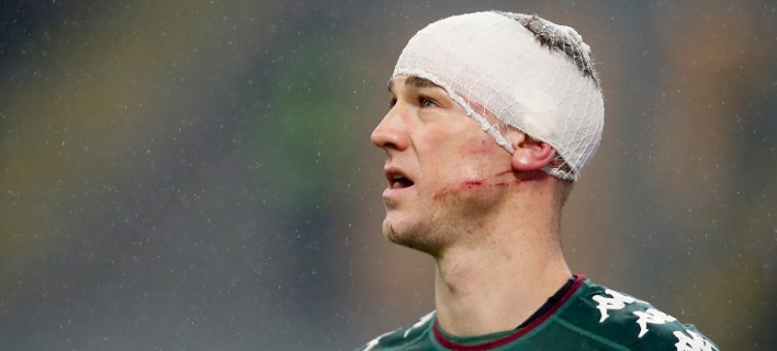 Οι τάπες του Λαπαντούλα «προσγειώθηκαν» στο κεφάλι του Χαρτ - Τα σημάδια στο πρόσωπο [βίντεο] | iefimerida.gr 0