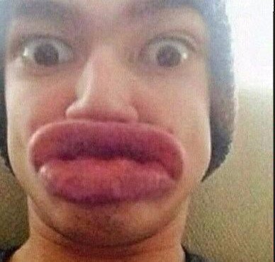 Γέλιο και πόνος -Γιατί οι έφηβοι μανιωδώς προσπαθούν να αποκτήσουν χείλη παπιού [εικόνες] | iefimerida.gr 0