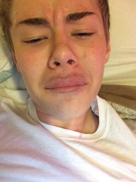 Γέλιο και πόνος -Γιατί οι έφηβοι μανιωδώς προσπαθούν να αποκτήσουν χείλη παπιού [εικόνες] | iefimerida.gr 12