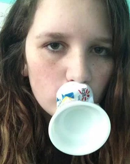 Γέλιο και πόνος -Γιατί οι έφηβοι μανιωδώς προσπαθούν να αποκτήσουν χείλη παπιού [εικόνες] | iefimerida.gr 3