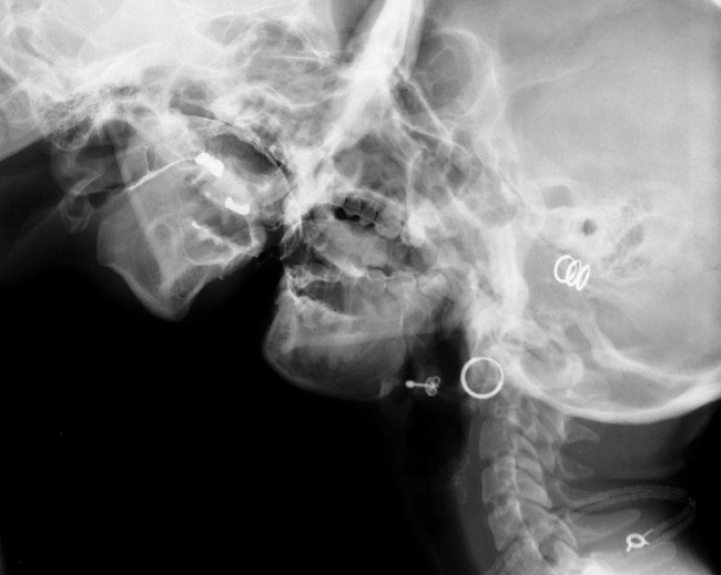 Οι πορνογραφικές ακτινογραφίες ενός αιρετικού καλλιτέχνη -Ωμές σεξουαλικές πράξεις με ακτίνες Χ [εικόνες] | iefimerida.gr 1