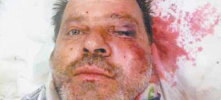 Ζάκυνθος: Του έκοψαν το ρεύμα και έδειρε τον υπάλληλο της ΔΕΗ [εικόνα] | iefimerida.gr 0