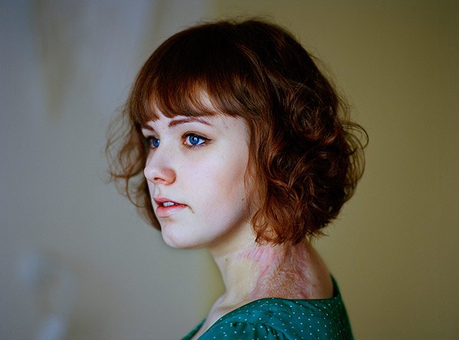 Τα συγκλονιστικά πορτραίτα των νέων που γλίτωσαν από τη φονική μανία του Μπρέιβικ βραβεύθηκαν σε διαγωνισμό [εικόνες] | iefimerida.gr 0