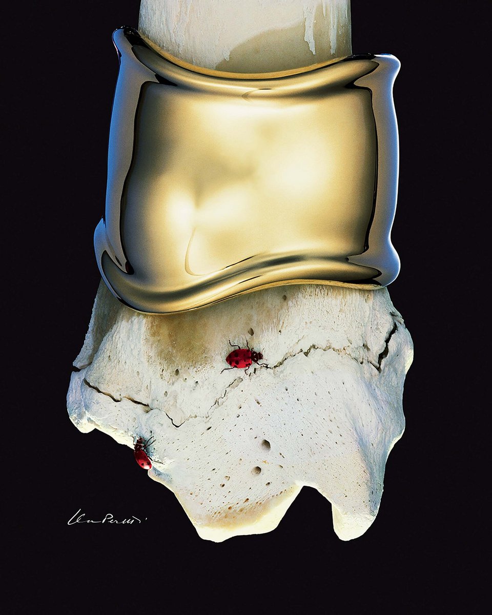 Το Bone Cuff της Περέτι για το Tiffany's που είχε εμπνευστεί από ανθρώπινα οστά που είχε δει σε εκκλησία του 17ου αιώνα.