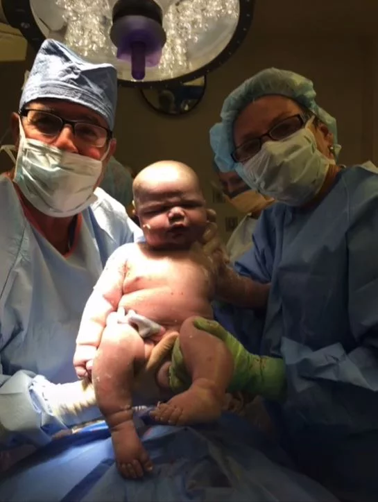Η φωτογραφία του μωρού με τους γιατρούς αμέσως μετά τη γέννησή του 