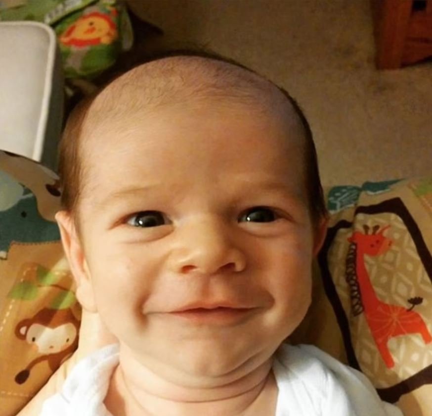 Τα αραιά μαλλιά του μωρού στην κορυφή του κεφαλιού αυτού του αγοριού το κάνουν να μοιάζει σαν να είναι ένας μεσήλικας άντρας που χάνει τα μαλλιά του. 