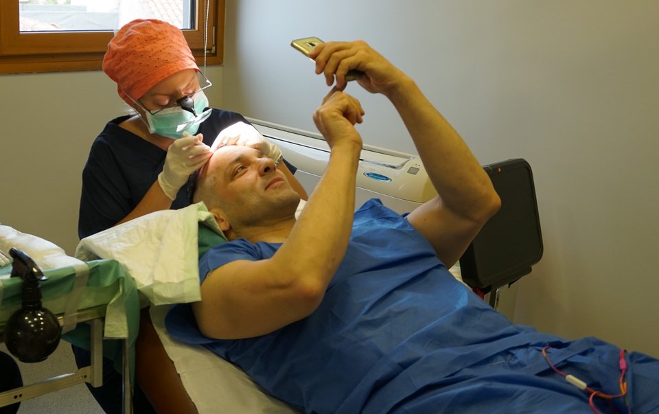 O δημοσιογράφος Μανώλης Μαυρομουστακάκης έχει υποβληθεί σε μεταμόσχευση μαλλιών Direct Hair Implantation.