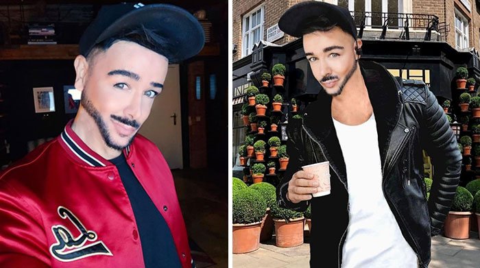 Αυτός ο χρήστης μέσων κοινωνικής δικτύωσης στο Λονδίνο χρησιμοποίησε λογισμικό εξομάλυνσης δέρματος για να κάνει το δέρμα του απίστευτα λείο. Δημιούργησε επίσης ένα απίστευτα λαξευμένο σαγόνι